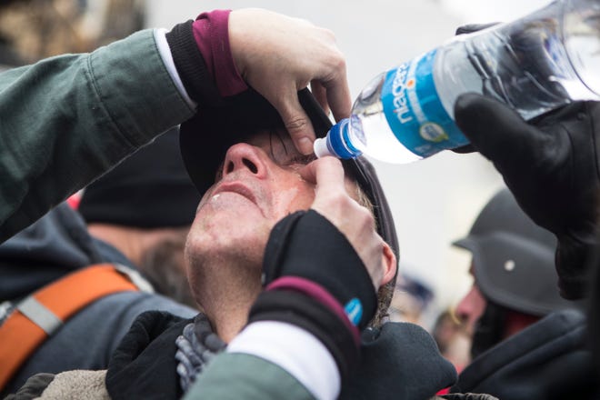 Jan 6, 2021; Washington, DC, USA; A Trump supporter receives aid after tear gas was deployed at rioters storming the U.S. Capitol Wednesday afternoon as lawmakers inside debated the certification of the presidential election.  Mandatory Credit: Jerry Habraken-USA TODAY